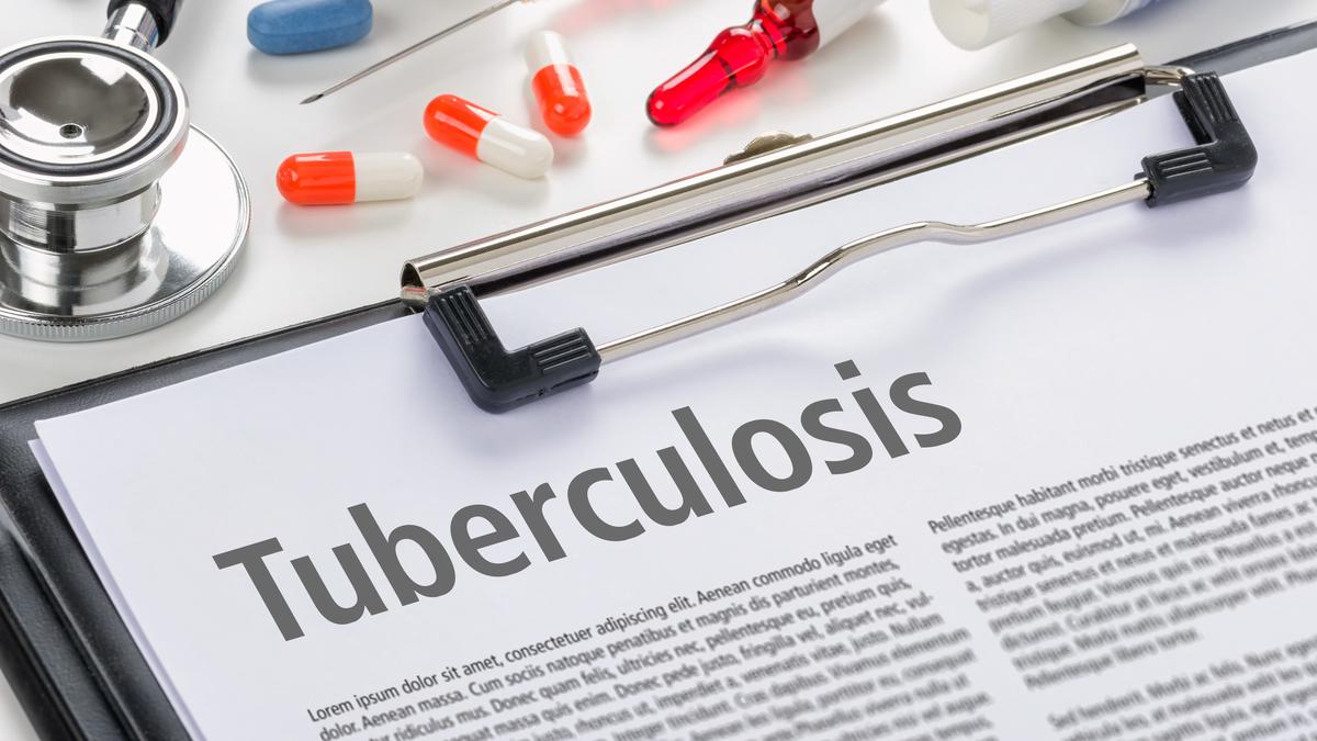 India needs innovative strategies to eliminate TB